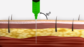 intradermal administer injections intramuscular