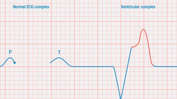 12 Lead Electrocardiogram For Medical Professionals Simtics - 